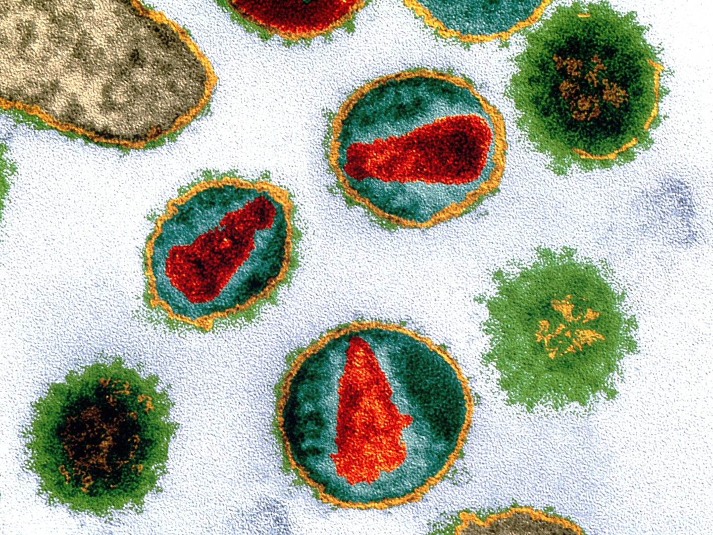 HIV