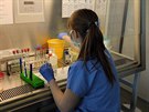 Kad den otestuje stav mikrobiologie v Olomouci a 200 vzork na koronavirus....
