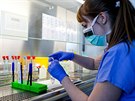 V Ústavu mikrobiologie olomoucké fakultní nemocnice se kadý den testují vzorky...