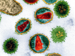 HIV