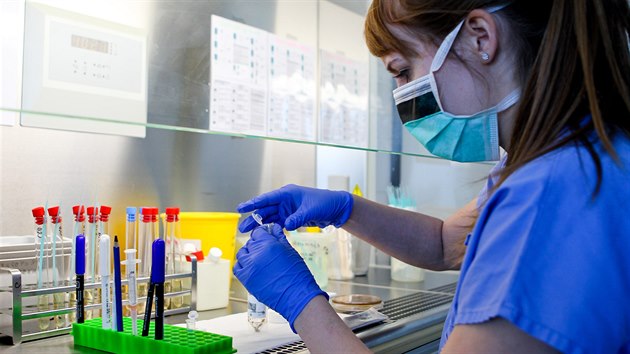 V Ústavu mikrobiologie olomoucké fakultní nemocnice se každý den testují vzorky na koronavirus.