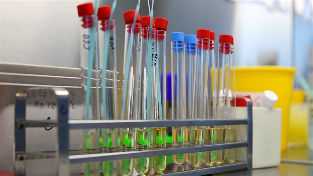 V Ústavu mikrobiologie olomoucké Fakultní nemocnice se každý den testují vzorky na koronavirus.