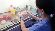 V Ústavu mikrobiologie olomoucké fakultní nemocnice se kadý den testují vzorky na koronavirus. Zájem o testy nyní výrazn vzrostl.