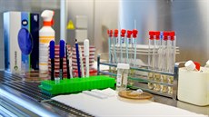 V Ústavu mikrobiologie olomoucké fakultní nemocnice se kadý den testují vzorky na koronavirus. Zájem o testy nyní výrazn vzrostl.