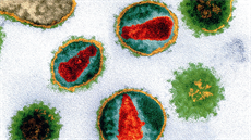 HIV