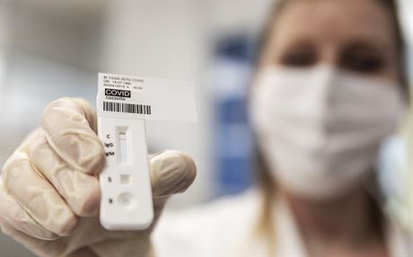 Zdravotnice ukazuje test na Covid-19 v laboratoi Colmar ve východní Francii....