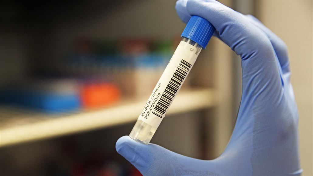 Ve Větrném Jeníkově odhalil test covid, podstoupí je další obyvatelé