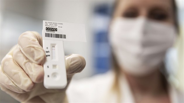 Zdravotnice ukazuje test na Covid-19 v laboratoi Colmar ve vchodn Francii. (14. dubna 2020)