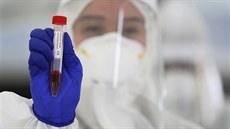 Filipínský zdravotník v ochranném obleku ukazuje odebraný vzorek pro testování...