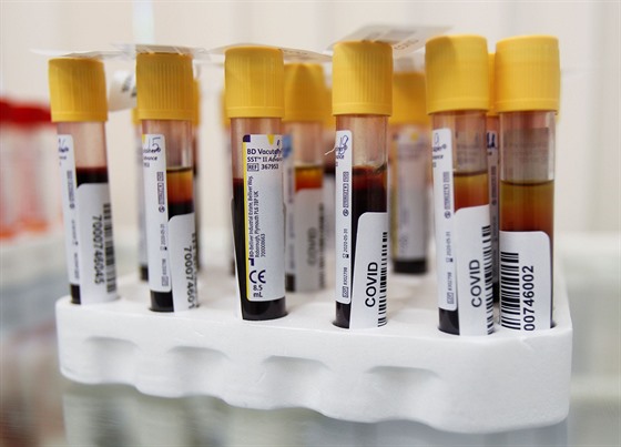 Odebrané vzorky krve na moskevské klinice. Vláda zahájila bezplatné hromadné...