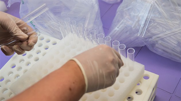 Jaromsk firma LabMediaServis ve svch laboratoch vyrb diagnostick roztoky na virov onemocnn.