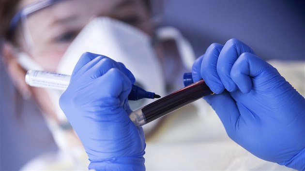Zamstnankyn Institutu Roberta Kocha oznauje vzorek krve pro test na covid-19 odebran starostovi nmeckho msta Kupferzell Christophu Spielesovi. (19. kvtna 2020)