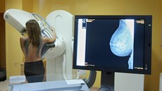 Olomoucká fakultní nemocnice představila nový moderní mamograf, který je v...