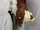 Indický léka v ochranném obleku pomáhá pacientovi s nemocí covid-19. (28....