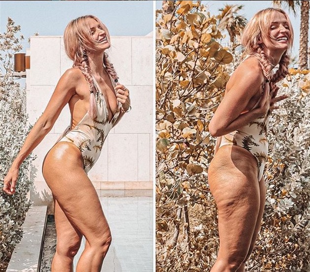 Influencerka propaguje reálná ženská těla s celulitidou