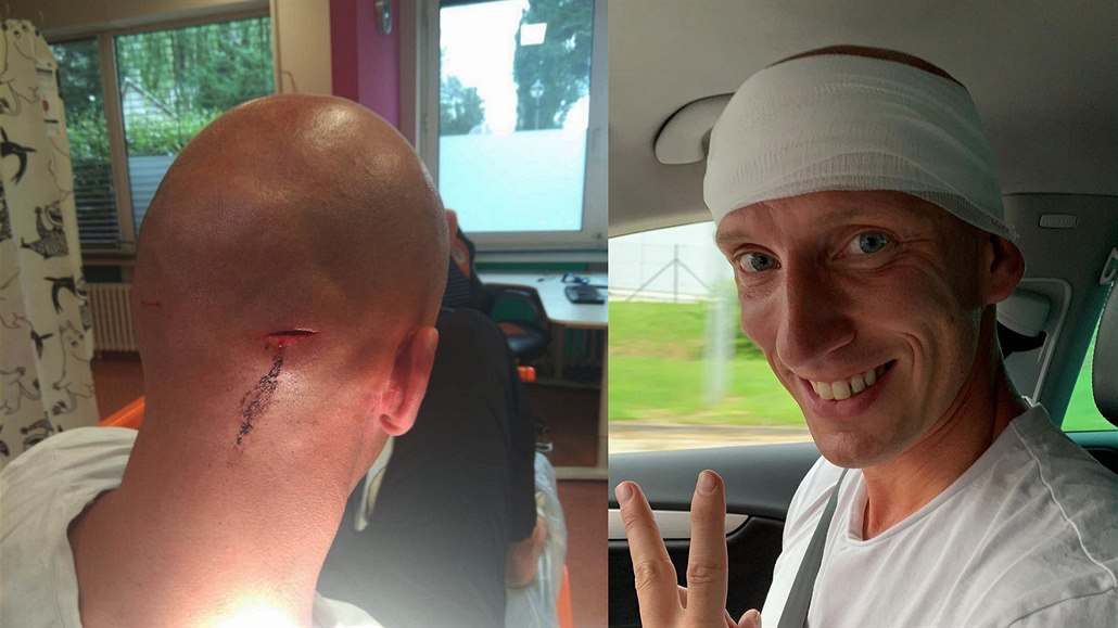 Český překážkář Petr Svoboda už zažil během své kariéry celou řadu zranění, která ho vyřadila z nejednoho závodu. Tentokrát je na nucené pauze kvůli napadení dvěma zloději.