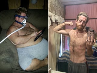 Zach Moore před operací a po ní