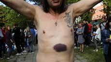 Jeden z bloruských demonstrant, které zbila policie ve vazební vznici. (14....