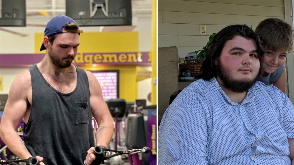 Muž držel bramborovou dietu, zhubl devadesát kilogramů