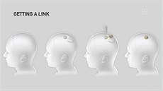 Jak si firma Neuralink pedstavuje implantování ipu do lidského mozku. (28....