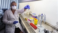 Olomoutí vdci z Ústavu Imunologie LF UP vyvinuli nový screeningový rychlotest...