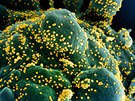Pro vstup viru SARS-CoV-2 do hostitelské buky je zásadní jeden z glykoprotein...
