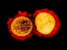 Koronavirus zpsobuje nemoc COVID-19, která ji nkolik msíc suuje svt.