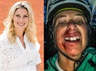 Andrea Sestini Hlaváková mla nehodu na kole