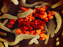 SARS-CoV-2 je zde zobrazen oranžově. Virus, který vědci izolovali z těla...