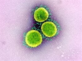 Zelené korunovité okraje viru vystupují z povrchu laboratorních buněk.