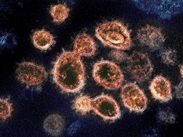Okraje připomínající korunu daly viru jeho označení – koronavirus.