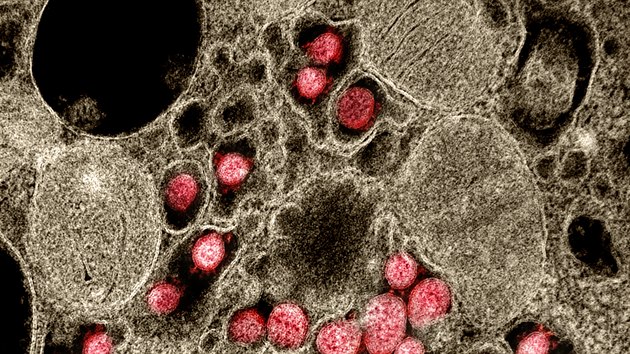 Vědci v NIAID snímky dodatečně barví, aby bylo virus lépe vidět.