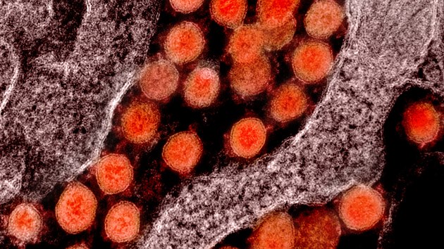Elektronový mikroskop zachycuje virus SARS-CoV-2. Virová částice viru SARS-CoV-2 má průměr 50–200 nanometru.