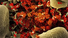 Snímek viru SARS-CoV-2. Fotku po�ídili pracovníci Národního institutu pro...