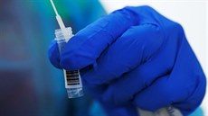 Zdravotnický pracovník provádí rychlý test PCR v mobilní laboratoi v rakouském...
