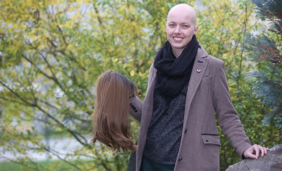 Třicetiletá Tereza Drahoňovská trpí alopecií. S nemocí se rozhodla bojovat....