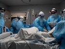 Zdravotníci na jednotce intenzivní pée v Houstonu oetují pacienta trpícího...