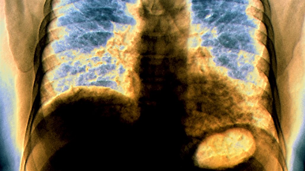 Ilustraní fotografie