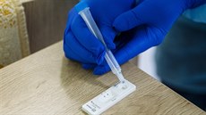 Domovy pro seniory obdr�ely rychlotesty na koronavirus a okam�it� za�aly s...