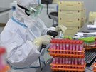 Zdravotnický pracovník skenuje vzorky nukleových kyselin pipravených pro...