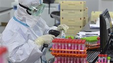 Zdravotnický pracovník skenuje vzorky nukleových kyselin pipravených pro...