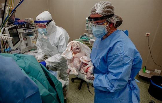 V Nemocnici Tomáše Bati ve Zlíně porodila císařským řezem maminka nakažená...