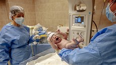 V Nemocnici Tomáe Bati ve Zlín porodila císaským ezem maminka nakaená...