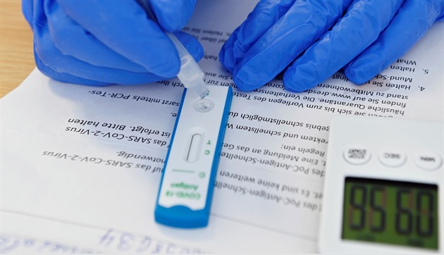 Pro PCR chybí kapacity, proto musí zůstat i antigenní testy, shodují se odborníci s opozicí