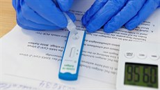 Po antigenních testech je v Německu je velká poptávka. (2021) | na serveru Lidovky.cz | aktuální zprávy