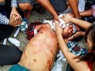 Demonstranti v Myanmaru (Barm) poskytují první pomoc zrannému, kterého...