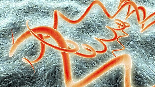 Syfilis je onemocnn penen pohlavn cestou, kter zpsobuje bakterie...