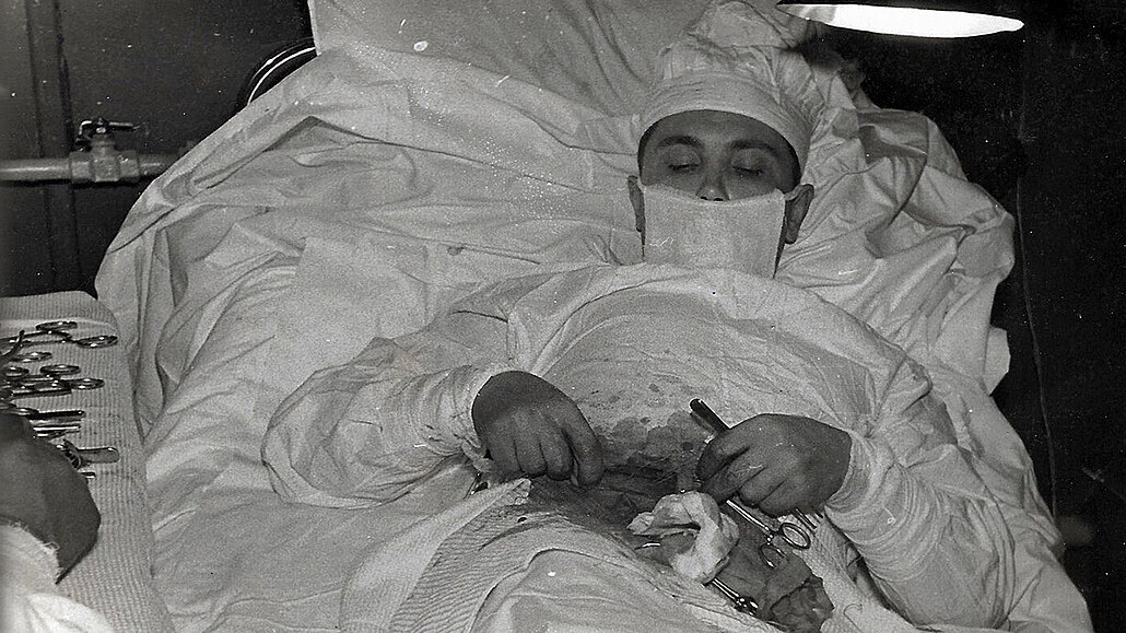 Leonid Rogozov při operaci slepého střeva.