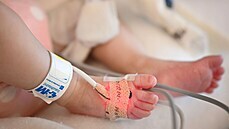 �pan�lským léka��m se v nemocnici v Madridu poda�ila unikátní transplantace...