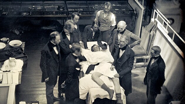 Operace s pouitm teru pro anestezii v bostonsk Massachusetts General Hospital, 1847. Dr. John Collins Warren (vpravo od pacienta) vysvtluje studentm postup.